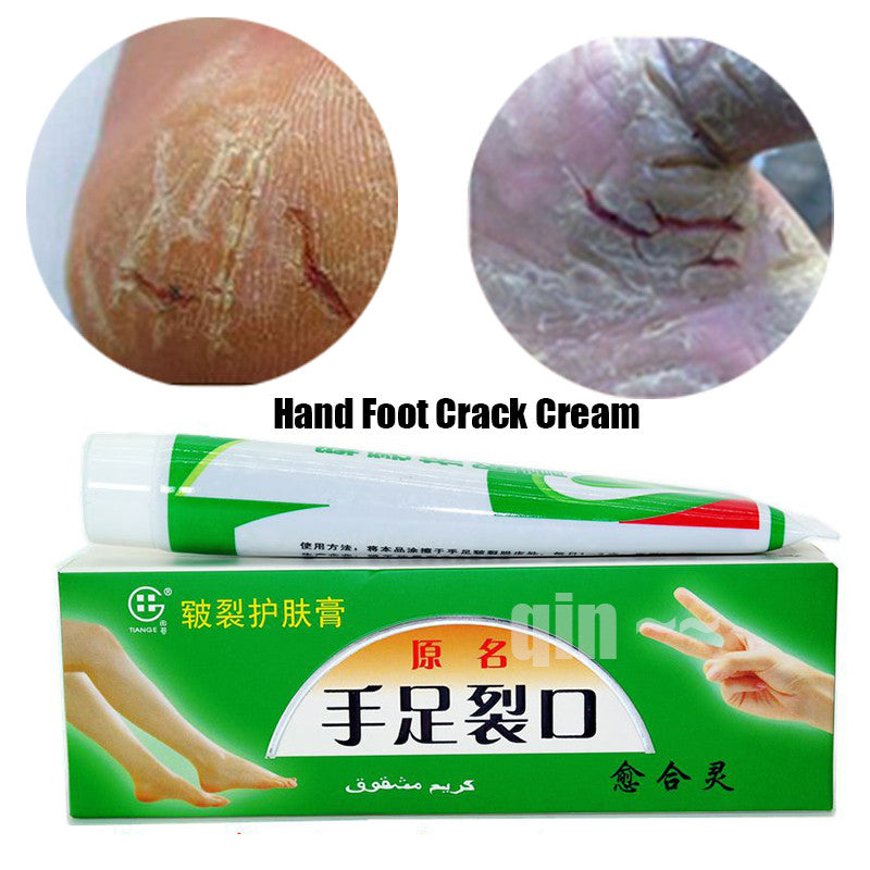 Hand Foot Crack Cream Heel Chapped Peeling Foot and hand Repair Anti Dry Crack Skin Chinese Medicinal Ointment Cream skin care - ModelSupplies